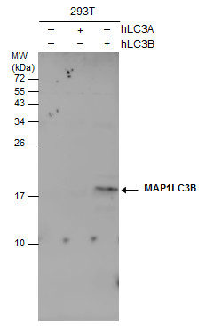 Non-transfected (â€“) and transfected (+) 293T whole cell extracts (30 ?g) were separated by 15% SDS-PAGE, and the membrane was blotted with LC3B antibody [GT3612] (GRP533) diluted at 1:500.