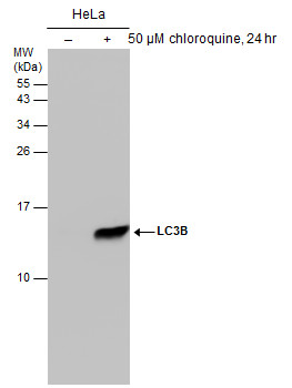 Untreated (â€“) and treated (+) HeLa whole cell extracts (50 ?g) were separated by 15% SDS-PAGE, and the membrane was blotted with LC3B antibody [GT3612] (GRP533) diluted at 1:500.