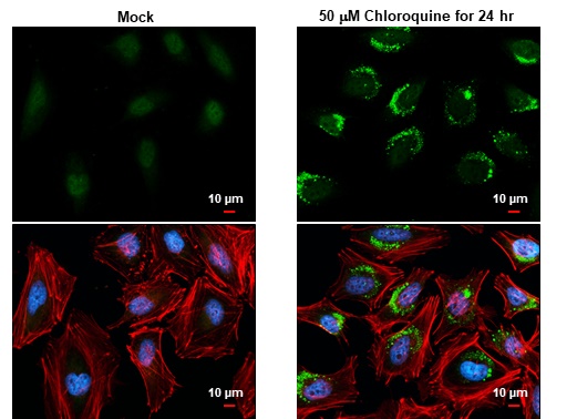 LC3B antibody detects LC3B protein at autophagosomeÂ  by immunofluorescent analysis.Sample: Mock and treated HeLa cells were fixed in 4% paraformaldehyde at RT for 15 min.Green: LC3B stained by LC3B antibody (GRP521) diluted at 1:500.Red: phalloidin, a cy