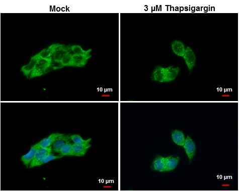LC3B antibody detects LC3B protein at autophagosome by immunofluorescent analysis. Samples: Hep G2 cells mock (left) and treated with 3 ?M Thapsigargin for 12 hrs (right) were fixed in ice-cold MeOH for 10 min and permeabilized with ice-cold acetone for 1