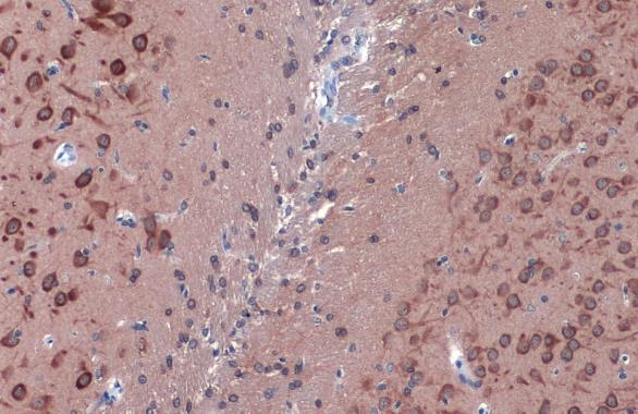 LC3B antibody detects LC3B protein at cytoplasm by immunohistochemical analysis.Sample: Paraffin-embedded rat brain.LC3B stained by LC3B antibody (GRP521) diluted at 1:500.Antigen Retrieval: Citrate buffer, pH 6.0, 15 min