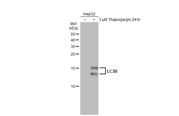 Untreated (â€“) and treated (+) HepG2 whole cell extracts (30 μg) were separated by 15% SDS-PAGE, and the membrane was blotted with LC3B antibody (GRP521) diluted at 1:1000. The HRP-conjugated anti-rabbit IgG antibody  was used to detect the primary an