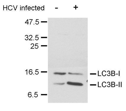 LC3B antibody detects LC3B protein in HCV-infected samples by western blot analysis. Â  A. 20 μg Huh7 whole cell lysate/extract (un-infected) Â  B. 20 μg Huh7 whole cell lysate/extract (HCV-infected) Â  LC3B antibody (GRP521) dilution: 1:1500 Â The 