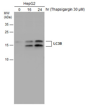 HepG2 cells were untreated or treated with 3 ?M thapsigargin for 16 and 24 hrs. Whole cell extracts (30 μg) were separated by 15% SDS-PAGE, and the membrane was blotted with LC3B antibody (GRP521) diluted at 1:1000. The HRP-conjugated anti-rabbit IgG a