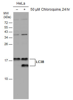 Untreated (â€“) and treated (+) HeLa whole cell extracts (30 μg) were separated by 15% SDS-PAGE, and the membrane was blotted with LC3B antibody (GRP521) diluted at 1:2500. The HRP-conjugated anti-rabbit IgG antibody  was used to detect the primary ant