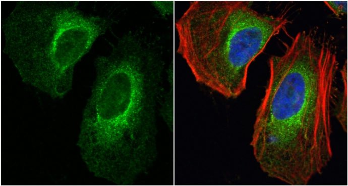 LDHA antibody detects LDHA protein at cytoplasm by immunofluorescent analysis.Sample: HeLa cells were fixed in 4% paraformaldehyde at RT for 15 min.Green: LDHA protein stained by LDHA antibody (GRP473) diluted at ) diluted at 1:200.Blue: Hoechst 33342 sta