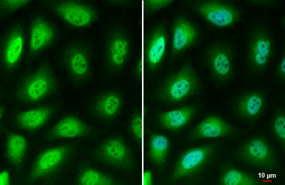 LOXL2 antibody detects LOXL2 protein by immunofluorescent analysis.Sample: HeLa cells were fixed in 4% paraformaldehyde at RT for 15 min.Green: LOXL2 stained by LOXL2 antibody (GRP488) diluted at 1:500.Blue: Hoechst 33342 staining.Scale bar= 10 ?m.