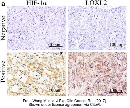 The IHC-P analysis of LOXL2 antibody was published by Wang M and colleagues in the journal J Exp Clin Cancer Res in 2017 .