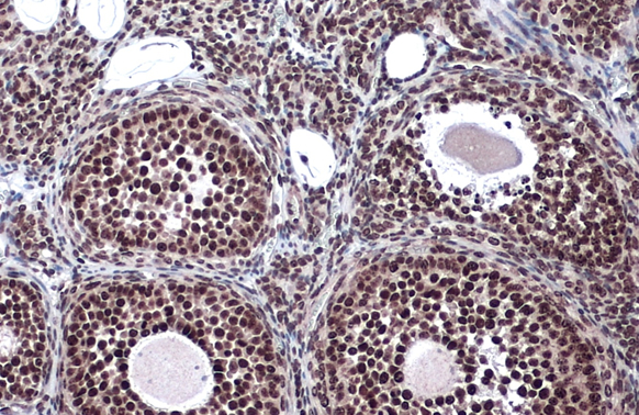 LOXL2 antibody detects LOXL2 protein at cytoplasm and nucleus by immunohistochemical analysis.Sample: Paraffin-embedded mouse ovary.LOXL2 stained by LOXL2 antibody (GRP488) diluted at 1:500.Antigen Retrieval: Citrate buffer, pH 6.0, 15 min