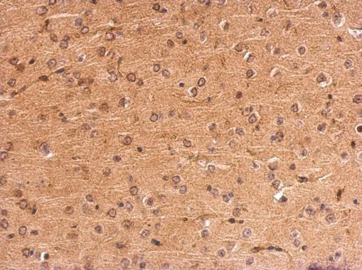 MC1 Receptor antibody [C2C3], C-term detects MC1R protein at membrane on mouse fore brain by immunohistochemical analysis. Sample: Paraffin-embedded mouse fore brain. MC1 Receptor antibody [C2C3], C-term (GRP575) dilution: 1:500.