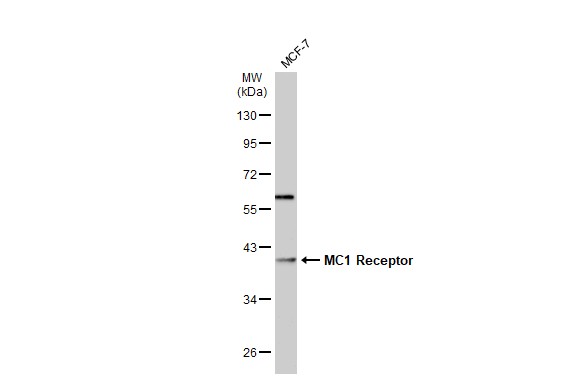 Whole cell extract (30 μg) was separated by 10% SDS-PAGE, and the membrane was blotted with MC1 Receptor antibody [C2C3], C-term (GRP575) diluted at 1:1000. The HRP-conjugated anti-rabbit IgG antibody  was used to detect the primary antibody.
