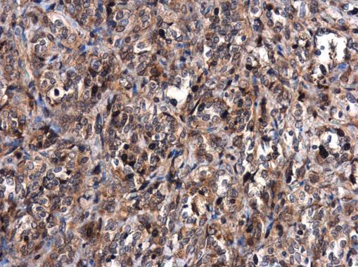 MDM2 antibody detects MDM2 protein at cytoplasm in human lung by immunohistochemical analysis. Sample: Paraffin-embedded human lung. MDM2 antibody (GRP461) diluted at 1:500.