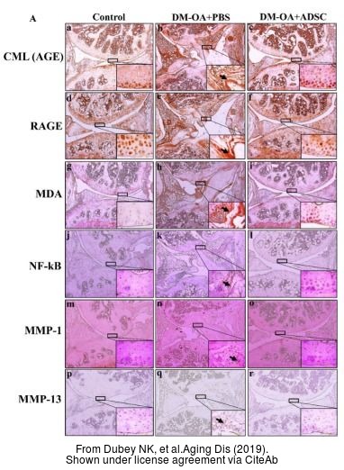 The IHC-P analysis of MMP1 antibody was published by Dubey NK and colleagues in the journal Aging Dis in 2019 .