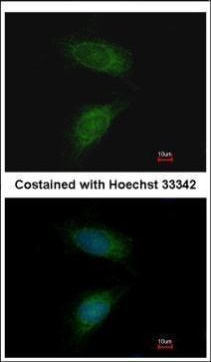 Immunofluorescence analysis of methanol-fixed HeLa, using MMP2(GRP486) antibody at 1:200 dilution.
