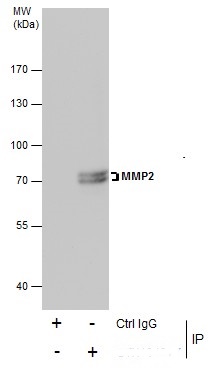 Immunoprecipitation of MMP2 protein from U87-MG whole cell extracts using 5 ?g of MMP2 antibody (GRP486).Western blot analysis was performed using MMP2 antibody (GRP486).EasyBlot anti-Rabbit IgG  was used as a secondary reagent.