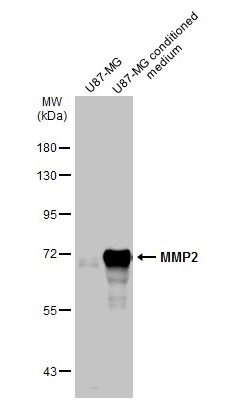 U87-MG whole cell extract and conditioned medium (30 μg) were separated by 7.5% SDS-PAGE, and the membrane was blotted with MMP2 antibody (GRP486) diluted at 1:6000. The HRP-conjugated anti-rabbit IgG antibody  was used to detect the primary antibody.