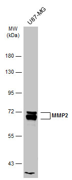 Whole cell extract (30 μg) was separated by 7.5% SDS-PAGE, and the membrane was blotted with MMP2 antibody (GRP486) diluted at 1:1000. The HRP-conjugated anti-rabbit IgG antibody  was used to detect the primary antibody.
