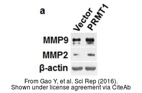 The WB analysis of MMP2 antibody was published by Gao Y and colleagues in the journal Sci Rep in 2016.PMID: 26813495
