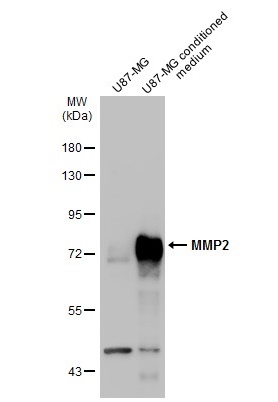 U87-MG whole cell extract and conditioned medium (30 μg) were separated by 7.5% SDS-PAGE, and the membrane was blotted with MMP2 antibody (GRP486) diluted at 1:1000. The HRP-conjugated anti-rabbit IgG antibody  was used to detect the primary antibody.
