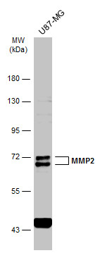 Whole cell extract (30 μg) was separated by 7.5% SDS-PAGE, and the membrane was blotted with MMP2 antibody (GRP486) diluted at 1:1000. The HRP-conjugated anti-rabbit IgG antibody  was used to detect the primary antibody.