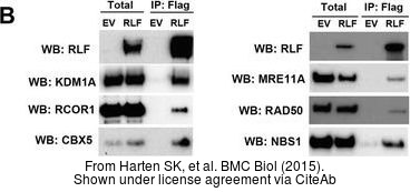The WB analysis of Mre11 antibody [12D7] was published by Harten SK and colleagues in the journal BMC Biol in 2015.PMID: 25857663