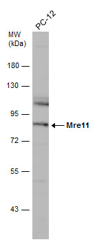 Whole cell extract (30 μg) was separated by 7.5% SDS-PAGE, and the membrane was blotted with Mre11 antibody [12D7] (GRP540) diluted at 1:500. The HRP-conjugated anti-mouse IgG antibody  was used to detect the primary antibody, and the signal was develo