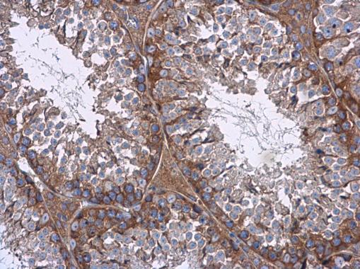 mTOR antibody [C3], C-term detects mTOR protein at cytoplasm in mouse testis by immunohistochemical analysis. Sample: Paraffin-embedded mouse testis. mTOR antibody [C3], C-term (GRP476) diluted at 1:500.