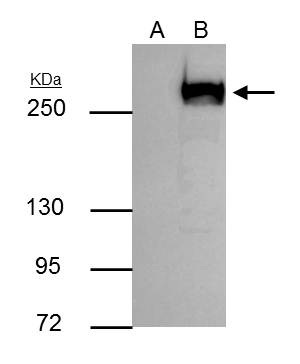 mTOR antibody immunoprecipitates mTOR protein in IP experiments. IP Sample: 293T whole cell lysate/extract A : Control with 3 ?g of pre-immune rabbit IgG B : Immunoprecipitation of mTOR by 3 ?g of mTOR antibody (GRP476) 5% SDS-PAGE The immunoprecipitated 