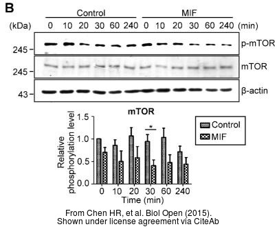 The WB analysis of mTOR antibody [C3], C-term was published by Chen HR and colleagues in the journal Biol Open in 2015.PMID: 25617421