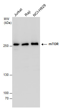 mTOR antibody detects mTOR protein by Western blot analysis. Various whole cell extracts (30 ?g) were separated by 5% SDS-PAGE, and the membrane was blotted with mTOR antibody (GRP476) diluted at a dilution of 1:1000.
