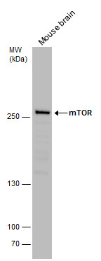 mTOR antibody detects mTOR protein by western blot analysis. Mouse tissue extracts (50 μg) was separated by 5% SDS-PAGE, and the membrane was blotted with mTOR antibody (GRP476) diluted by 1:500. The HRP-conjugated anti-rabbit IgG antibody  was used to