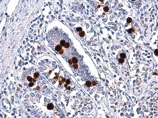 MUC2 antibody [C3], C-term detects secreted MUC2 protein in human intestine by immunohistochemical analysis. Sample: Paraffin-embedded human intestine. MUC2 antibody [C3], C-term (GRP466) diluted at 1:750.