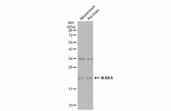 Various tissue extracts (50 μg) were separated by 12% SDS-PAGE, and the membrane was blotted with N-RAS antibody (GRP494) diluted at 1:1000. The HRP-conjugated anti-rabbit IgG antibody  was used to detect the primary antibody.