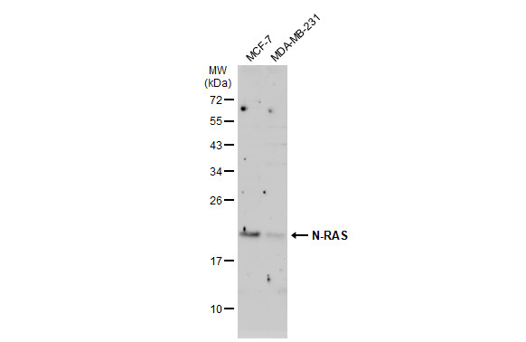 Various whole cell extracts (30 μg) were separated by 12% SDS-PAGE, and the membrane was blotted with N-RAS antibody (GRP494) diluted at 1:1000. The HRP-conjugated anti-rabbit IgG antibody  was used to detect the primary antibody, and the signal was de