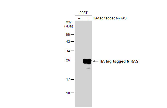 Non-transfected (â€“) and transfected (+) 293T whole cell extracts (30 μg) were separated by 12% SDS-PAGE, and the membrane was blotted with N-RAS antibody (GRP494) diluted at 1:5000. The HRP-conjugated anti-rabbit IgG antibody  was used to detect the 