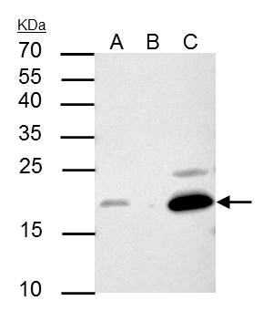 p21 Cip1 antibody [GT1032] immunoprecipitates CDKN1A protein in IP experiments.IP samples: HCT-116 whole cell extract treat with 30uM cisplatin for 48 hrA. 30 ?g HCT-116 whole cell extract treat with 30uM cisplatin for 48 hrB. Control with 4 ?g of preimmu