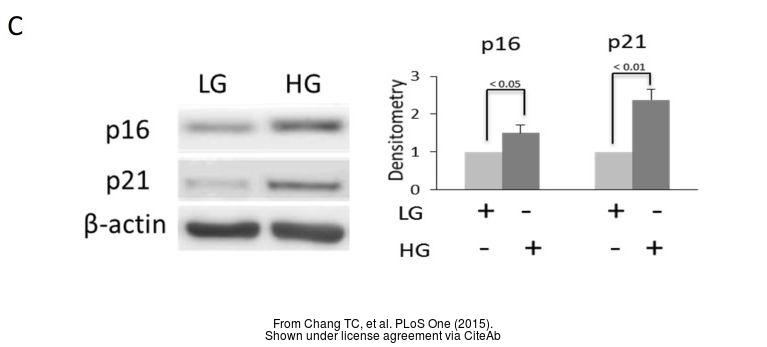 The WB analysis of p21 Cip1 antibody [GT1032] was published by Chang TC and colleagues in the journal PLoS One in 2015.PMID: 25961745