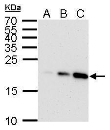 p21 Cip1 antibody [GT1032] detects p21 Cip1 protein by western blot analysis.A. 30 μg HCT116 whole cell lysate/extract (untreated)B. 30 μg HCT116 whole cell lysate/extract (30 μM Cisplatin treatment for 24 hr)C. 30 μg HCT116 whole cell lysate/