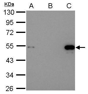 Immunoprecipitation of p53 protein. HCT116 lysates with 30uM cisplatin treatment for 24 hours were subjected to immunoprecipitation using (B) normal rabbit IgG or (C) 2.5 ug of anti-p53 antibody (GRP482)) Input, 20ug of HCT116 lysates. The precipitated pr