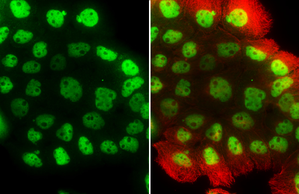 p63 antibody [N2C1], Internal detects p63 protein at nucleus by immunofluorescent analysis.Sample: A431 cells were fixed in 4% paraformaldehyde at RT for 15 min.Green: p63 stained by p63 antibody [N2C1], Internal (GRP478) diluted at 1:500.Red: alpha Tubul