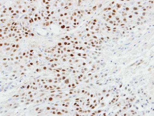 Immunohistochemical analysis of paraffin-embedded SCC4 xenograft, using p63(GRP478) antibody at 1:100 dilution.