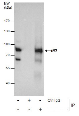 Immunoprecipitation of p63 protein from A431 whole cell extracts using 5 ?g of p63 antibody [N2C1], Internal (GRP478).Western blot analysis was performed using p63 antibody [N2C1], Internal (GRP478).EasyBlot anti-Rabbit IgG  was used as a secondary reagen