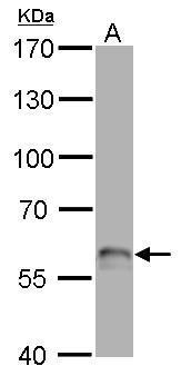 p63 antibody [N2C1], Internal detects TP63 protein by western blot analysis.A. 50 μg rat brain lysate/extract7.5% SDS-PAGEp63 antibody [N2C1], Internal (GRP478) dilution: 1:500 The HRP-conjugated anti-rabbit IgG antibody  was used to detect the primary