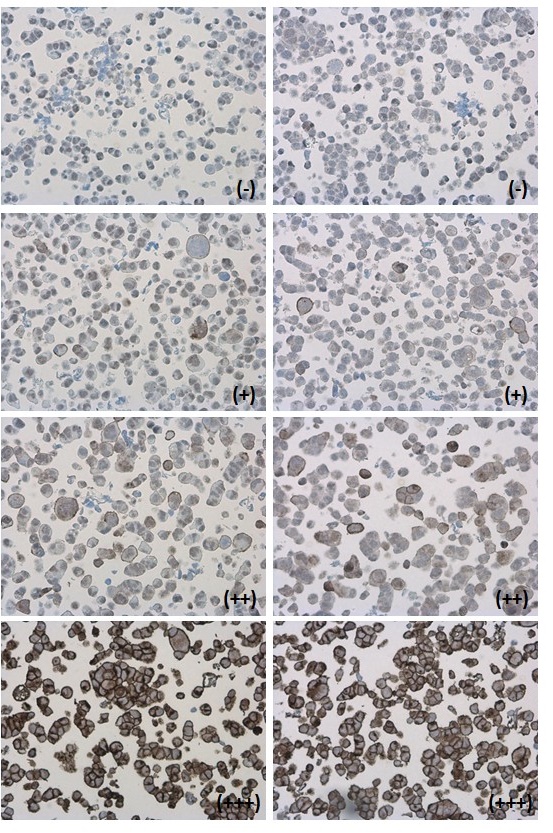 PD-L1 antibody detects PD-L1 protein at cell membrane in PD-L1 protein-expressing cell lines by immunohistochemical analysis.  Antibodies: PD-L1 antibody (GRP487) diluted at 1:1000, and competitor's antibody diluted at 1:50. Samples:  Negative (-), low po