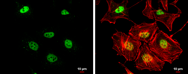 Rad50 antibody [13B3] detects Rad50 protein at nucleus by immunofluorescent analysis.Sample: HeLa cells were fixed in 4% paraformaldehyde at RT for 15 min.Green: Rad50 protein stained by Rad50 antibody [13B3] (GRP541) diluted at 1:200.Red: phalloidin, a c