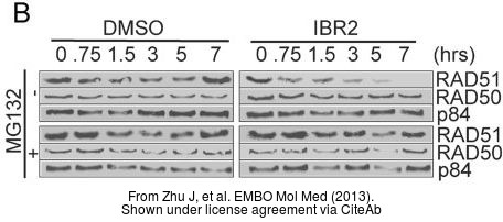 The WB analysis of Rad50 antibody [13B3] was published by Zhu J and colleagues in the journal EMBO Mol Med in 2013.PMID: 23341130