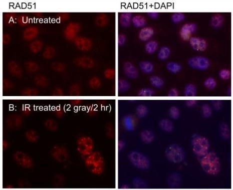 Immunofluorecent staning of RAD51 nuclear foci in U2OS cells using RAD51 14B4 antibody (GRP542). Cells were pre-extracted with CSK buffer before fixation with 4% PFA. RAD51 14B4 was used at 1:1000 dultion. DAPI was used to counterstain the nucleus. Scale 
