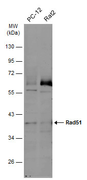Various whole cell extracts (30 μg) were separated by 10% SDS-PAGE, and the membrane was blotted with Rad51 antibody [14B4] (GRP542) diluted at 1:500. The HRP-conjugated anti-mouset IgG antibody  was used to detect the primary antibody, and the signal 