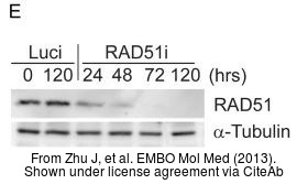 The WB analysis of Rad51 antibody [14B4] was published by Zhu J and colleagues in the journal EMBO Mol Med in 2013.PMID: 23341130