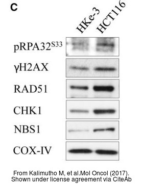 The WB analysis of Rad51 antibody [14B4] was published by Kalimutho M and colleagues in the journal Mol Oncol in 2017 .